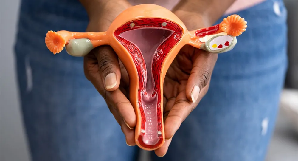 Καρκίνος Ωοθηκών ovarian cancer